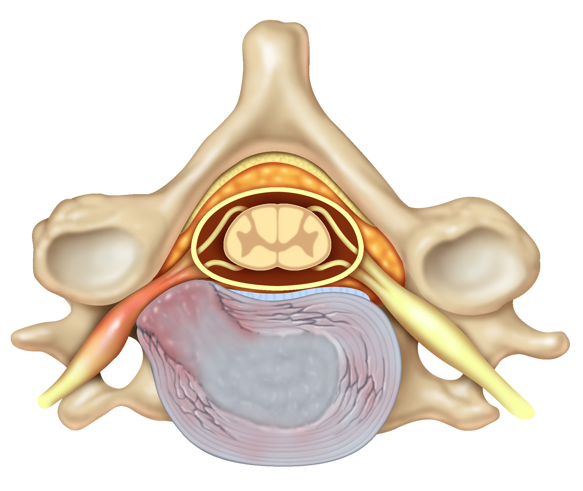 Pinched Nerve In Neck Causes Symptoms And Treatments